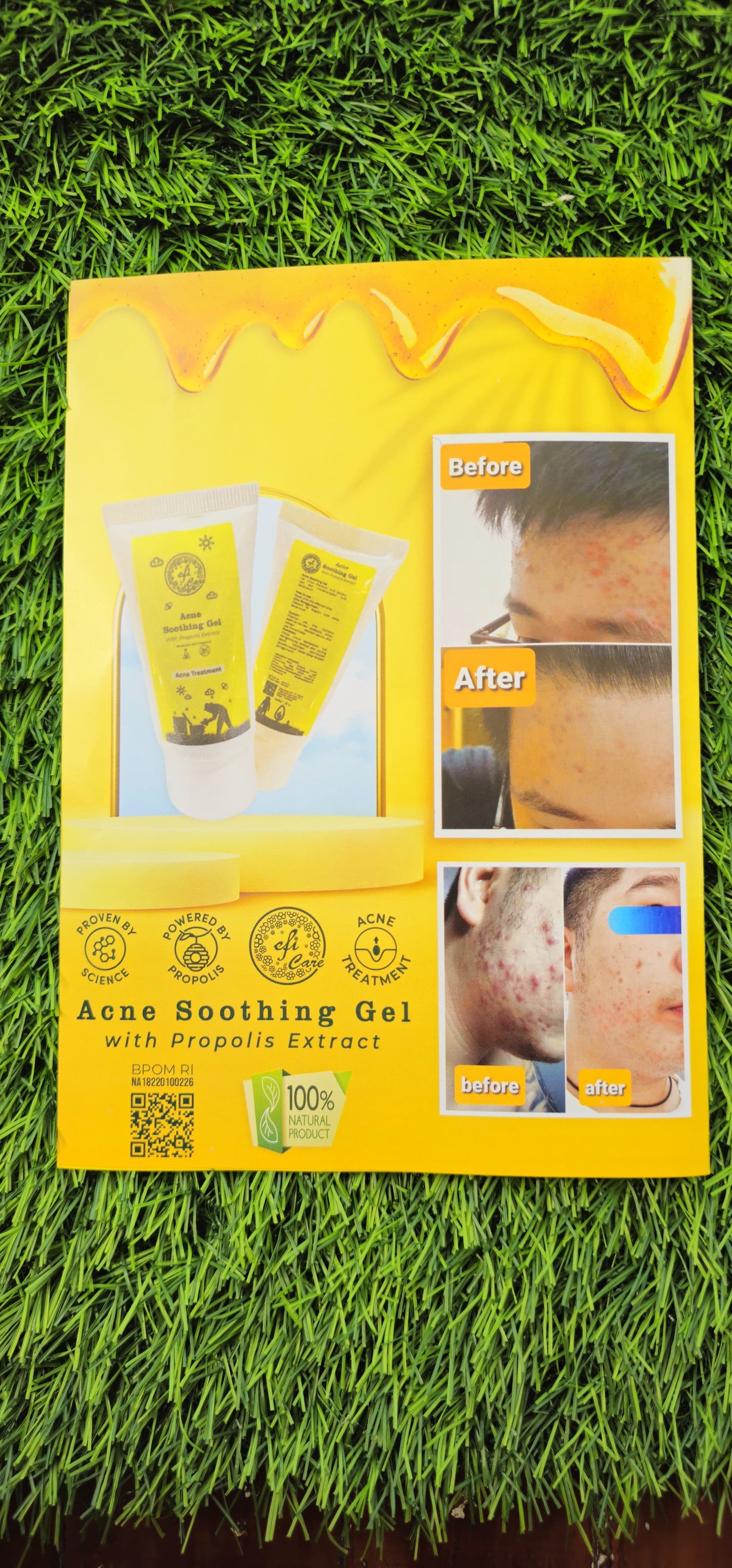 Efi Acne Soothing Gel (15 gram) 0% Alcohol, 0% Fragrance