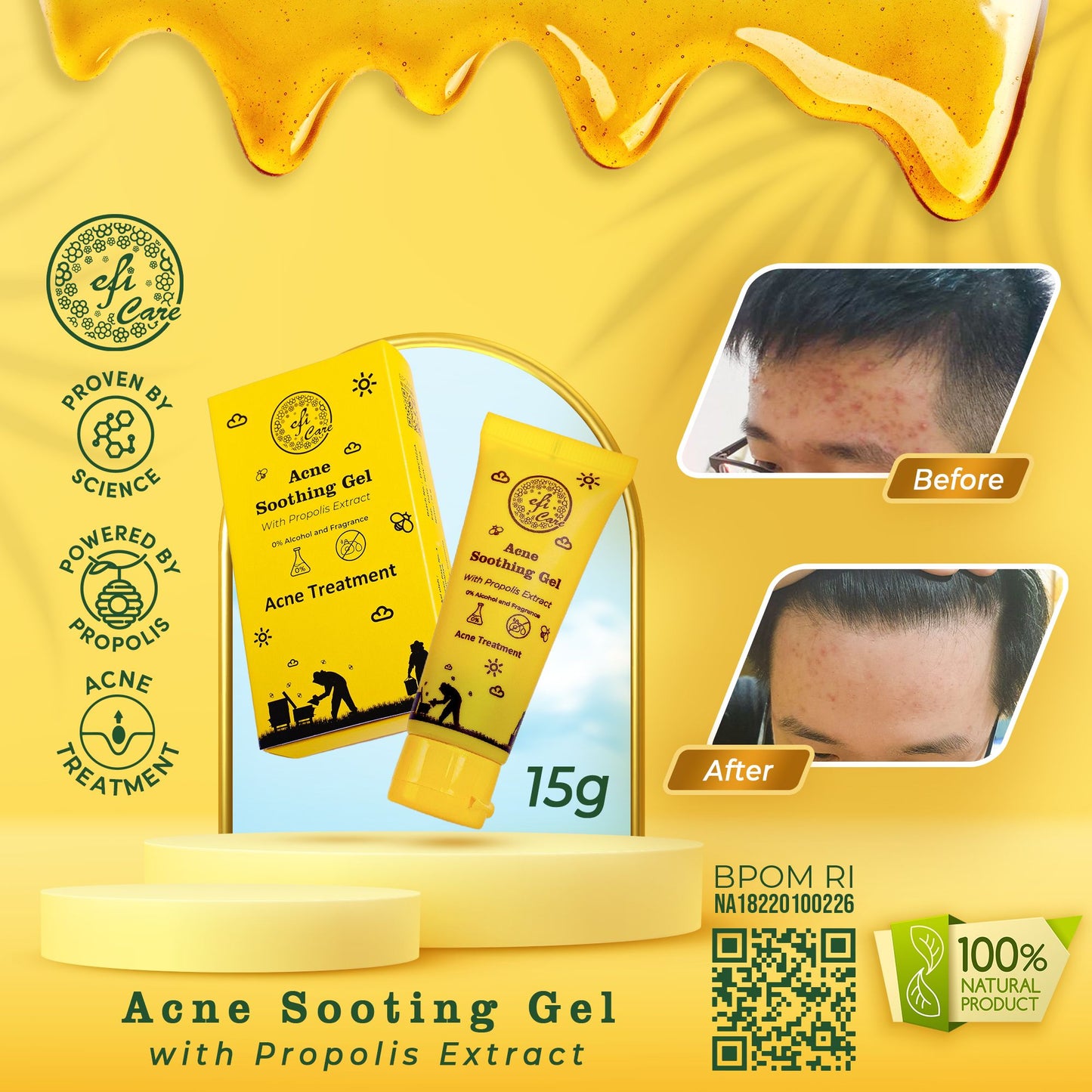 Discount 25% (3 pcs) - Eficare Acne Soothing Gel